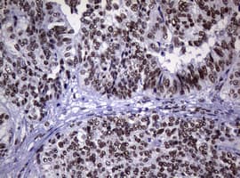 NBN / Nibrin Antibody (clone OTI7D5)