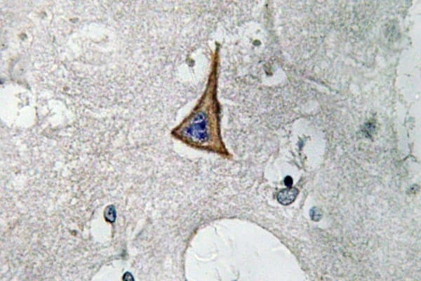 NRP1 / Neuropilin 1 Antibody (Asp525)