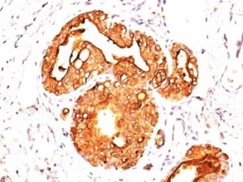 EMA / MUC1 Antibody (clone MUC1/845)