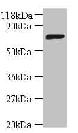 Polyclonal Rabbit anti-E. coli DNA Ligase Antibody (IHC, WB)