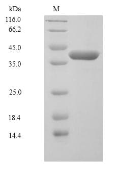 Human MAP2K6 / MEK6 / MKK6 Protein (Recombinant 6His, N-terminus)