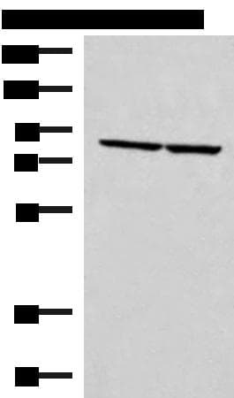 Polyclonal Rabbit anti-Human ABLIM3 Antibody (WB)