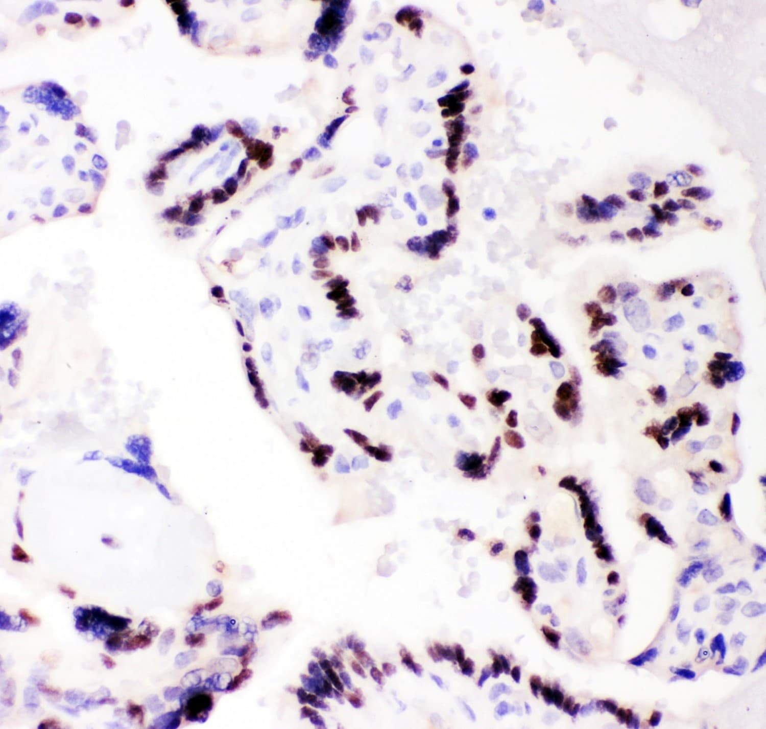 C/EBP Beta / CEBPB Antibody (aa1-200)