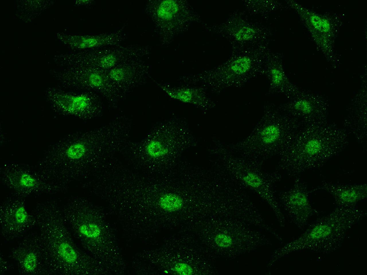 SMAD6 Antibody