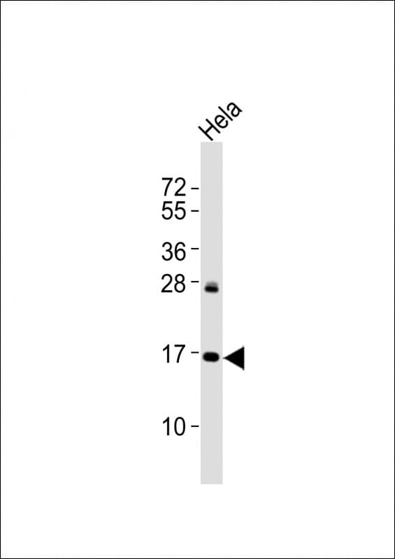 p16INK4a / CDKN2A Antibody (Ser152)