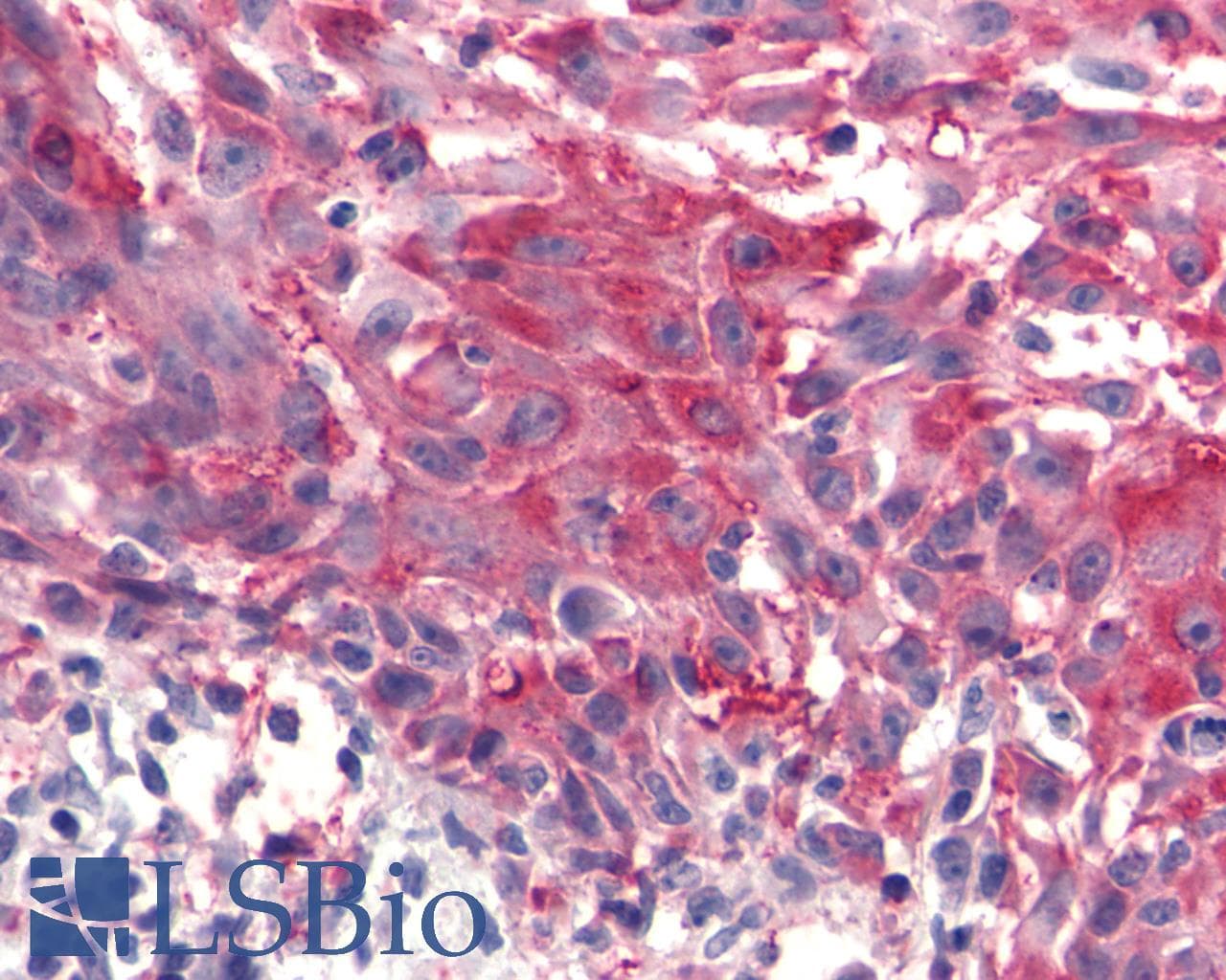 PathPlus™ FZD4 / Frizzled 4 Antibody (C-Terminus)