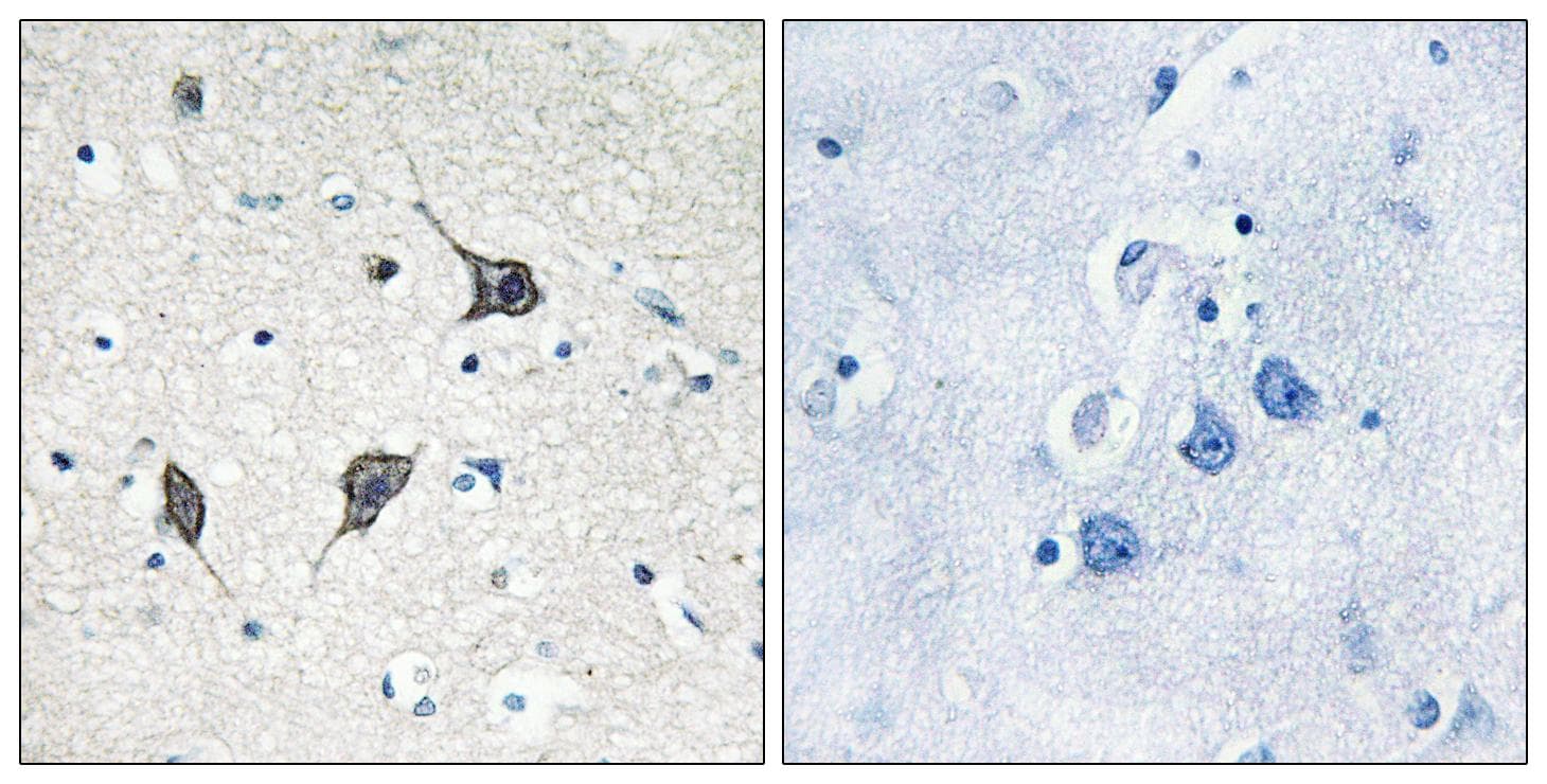 Polyclonal Rabbit anti-Human GPR20 Antibody (IHC, IF, WB)
