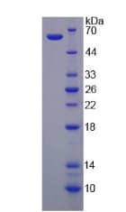 Human VDAC1 / PORIN Protein (Recombinant His-GST)