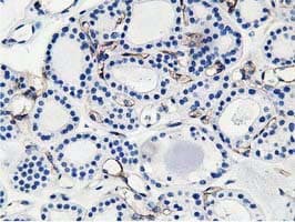 Adiponectin Antibody (aa19-244, clone OTI1B2, Carrier-free)