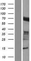 CCDC85A Protein (Over-Expression Lysate Myc-DDK (Flag))