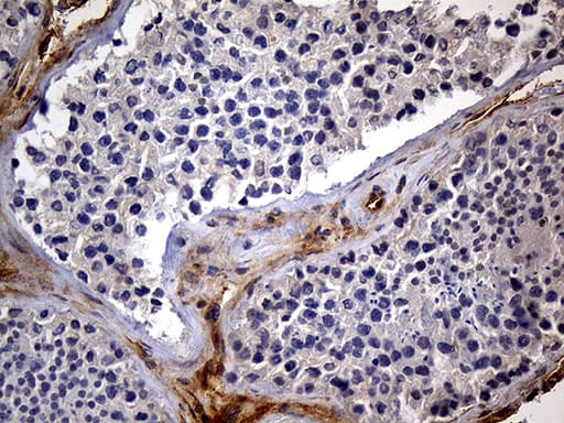 IMP-3 / IGF2BP3 Antibody (clone OTI6A4)