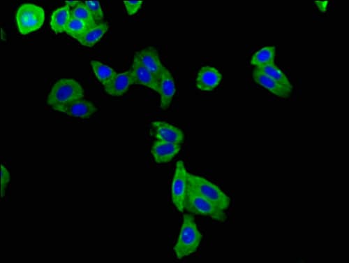 KCNE1 / MinK Antibody
