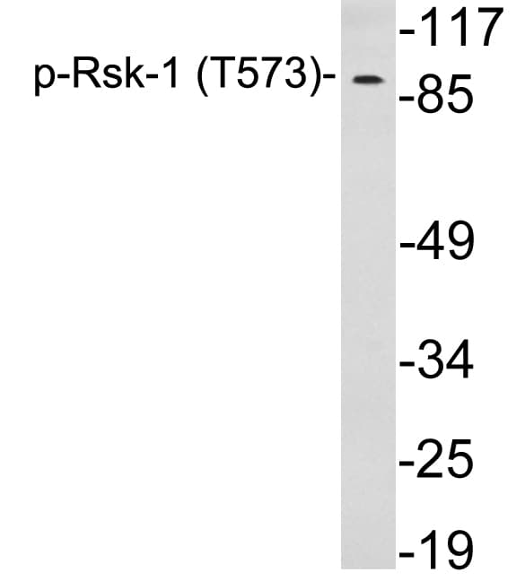 RPS6KA1 / RSK1 Antibody (phospho-Thr573)