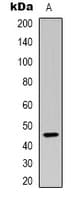 KLKB1 / Plasma Kallikrein Antibody (Internal)