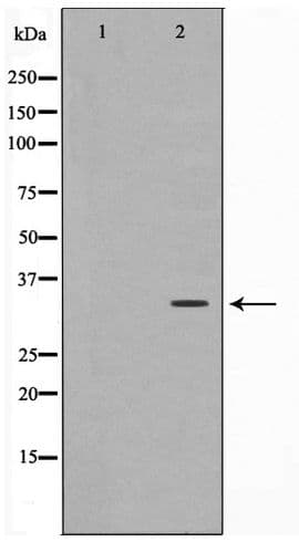 Polyclonal Rabbit anti-Human C/EBP Epsilon / CEBPE Antibody (IHC, IF, WB)