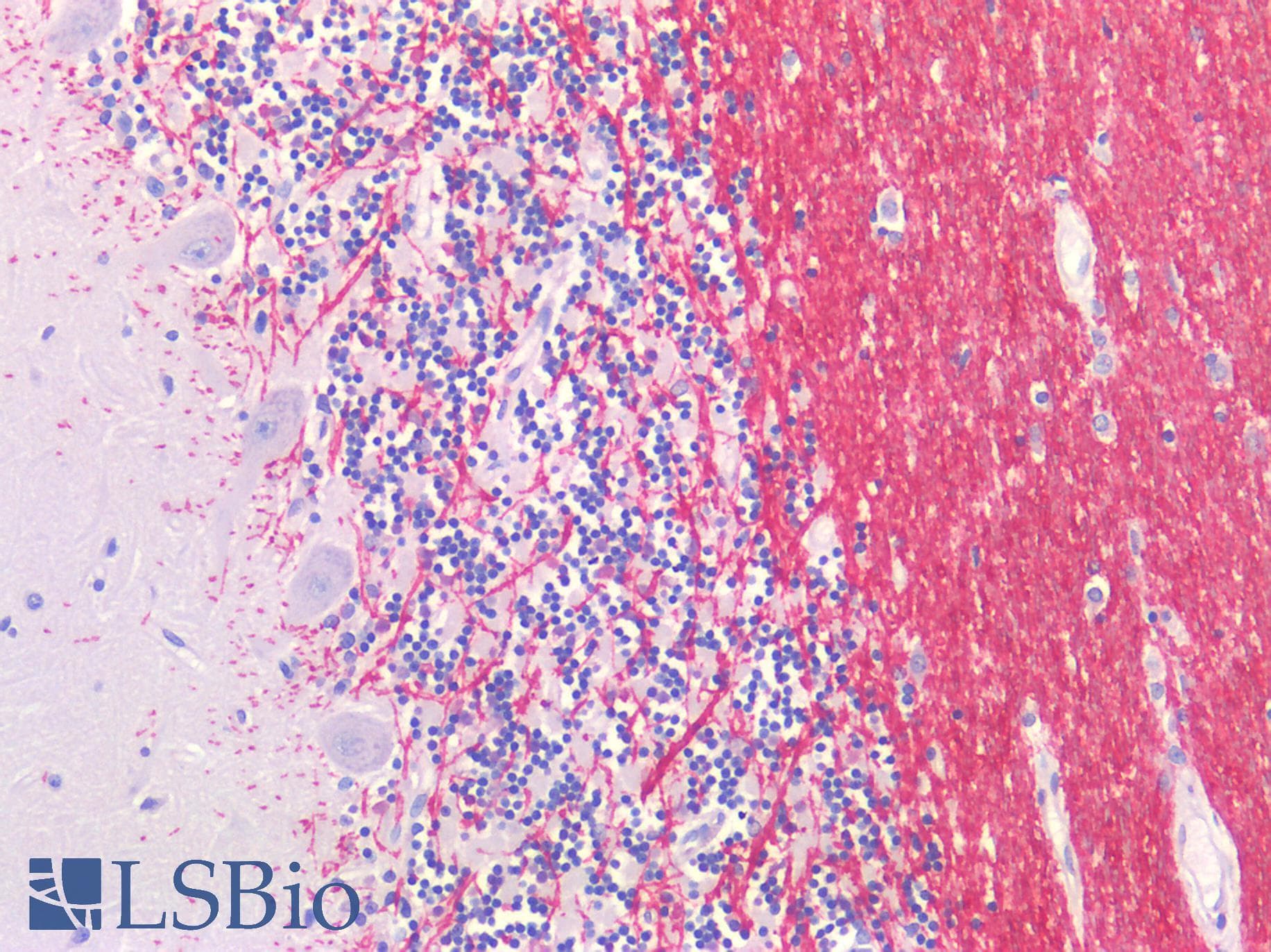 PathPlus™ GLUL / Glutamine Synthetase Antibody