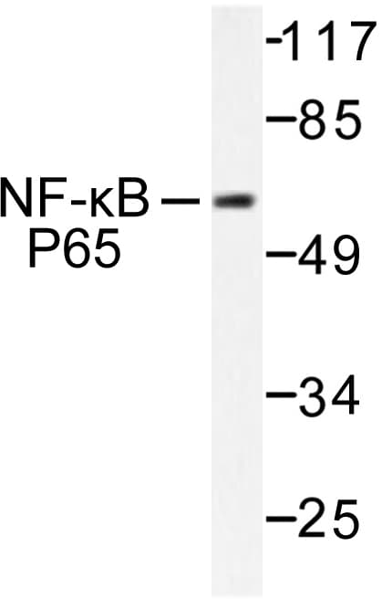 RELA / NFKB p65 Antibody (Thr429)