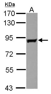 Polyclonal Rabbit anti-Human GAB2 Antibody (WB)