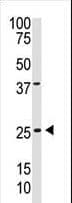 Polyclonal Rabbit anti-Human PDGF-BB Antibody (aa212-241, IF, WB)