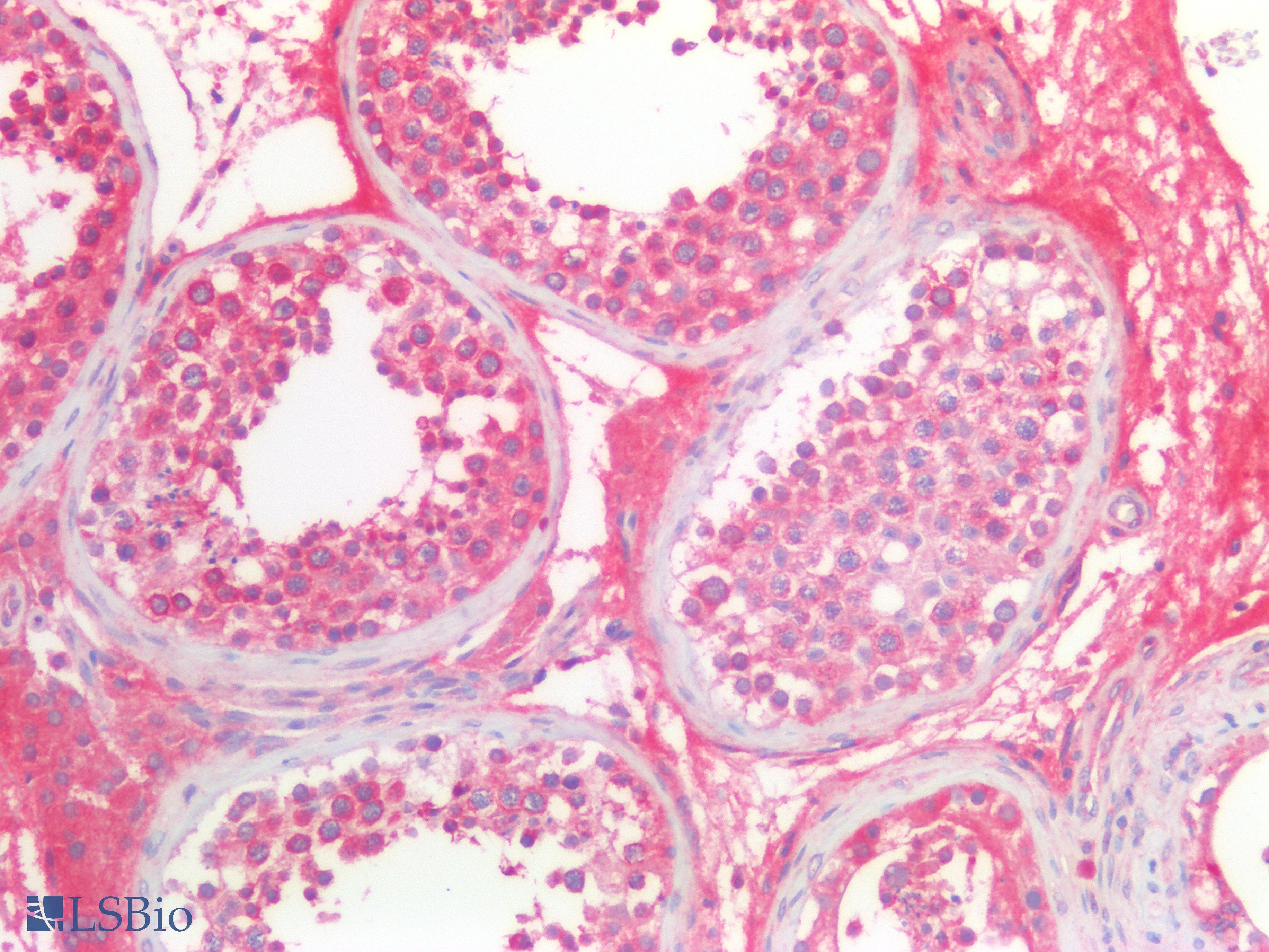 PathPlus™ Polyclonal Rabbit anti-Human RASSF1 / RASSF1A Antibody (IHC, IF, WB)
