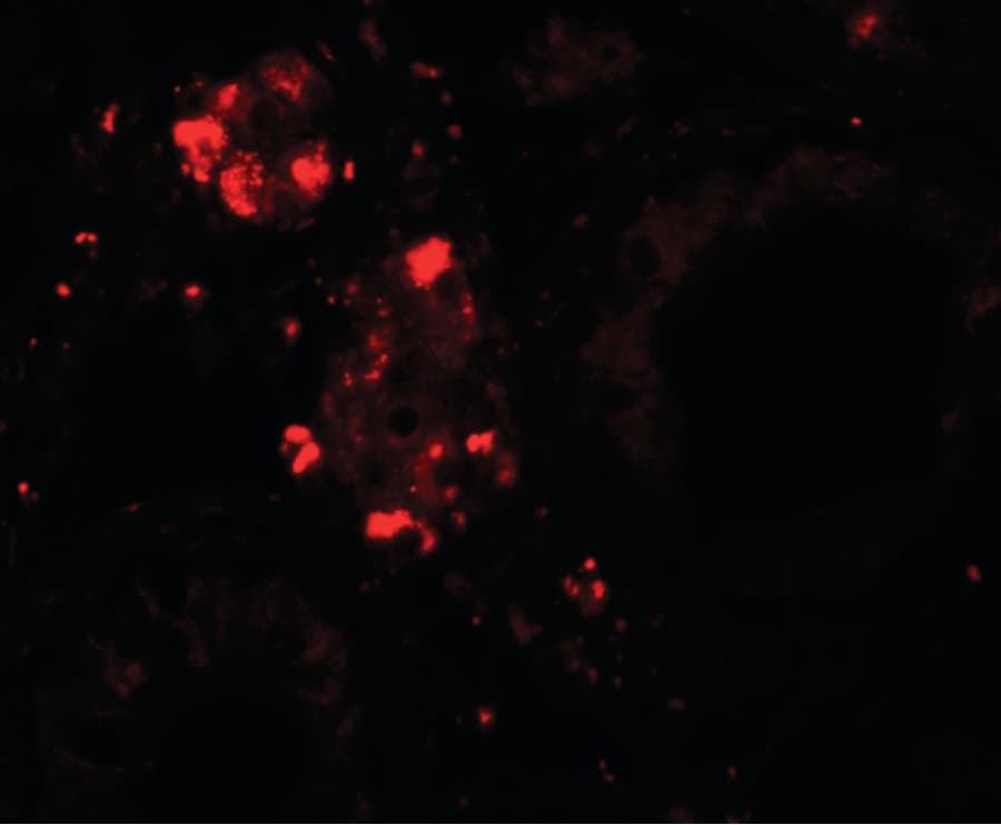 IHC-plus™ Polyclonal Rabbit anti-Human WDR92 Antibody (IHC, IF, WB)
