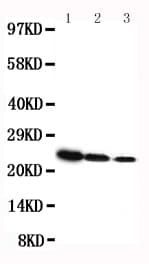 GH / Growth Hormone Antibody (aa27-216)