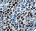 Recombinant Monoclonal Rabbit anti-Human CCND1 / Cyclin D1 Antibody (clone RBT-14, Ready-to-Use, IHC)