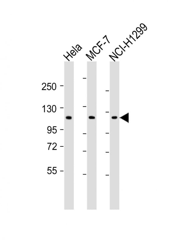Polyclonal Rabbit anti-Human PPP1R13L / iASPP Antibody (aa455-485, WB)