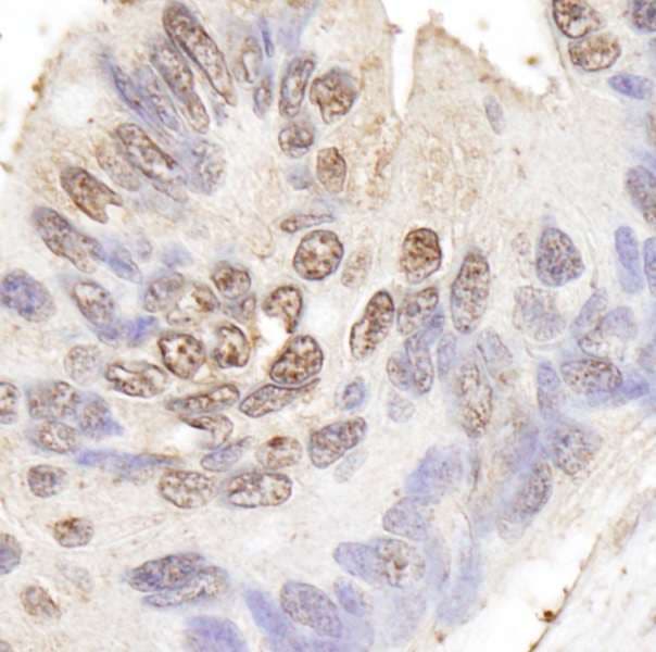 BLAP75 / RMI1 Antibody (aa275-300)