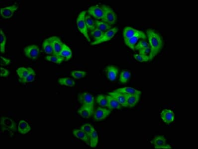 Polyclonal Rabbit anti-Human GOLPH3 Antibody (IHC, WB)