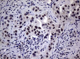 NBN / Nibrin Antibody (clone OTI3A4)