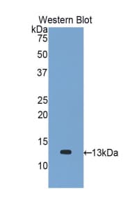 CCL2 / MCP1 Antibody (aa24-125)