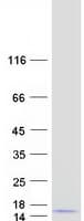 Human C18orf32 Protein (Recombinant Myc-DDK (Flag))