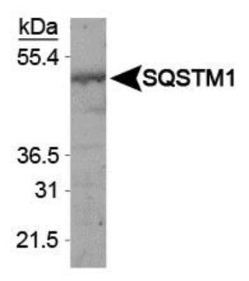IHC-plus™ SQSTM1 Antibody