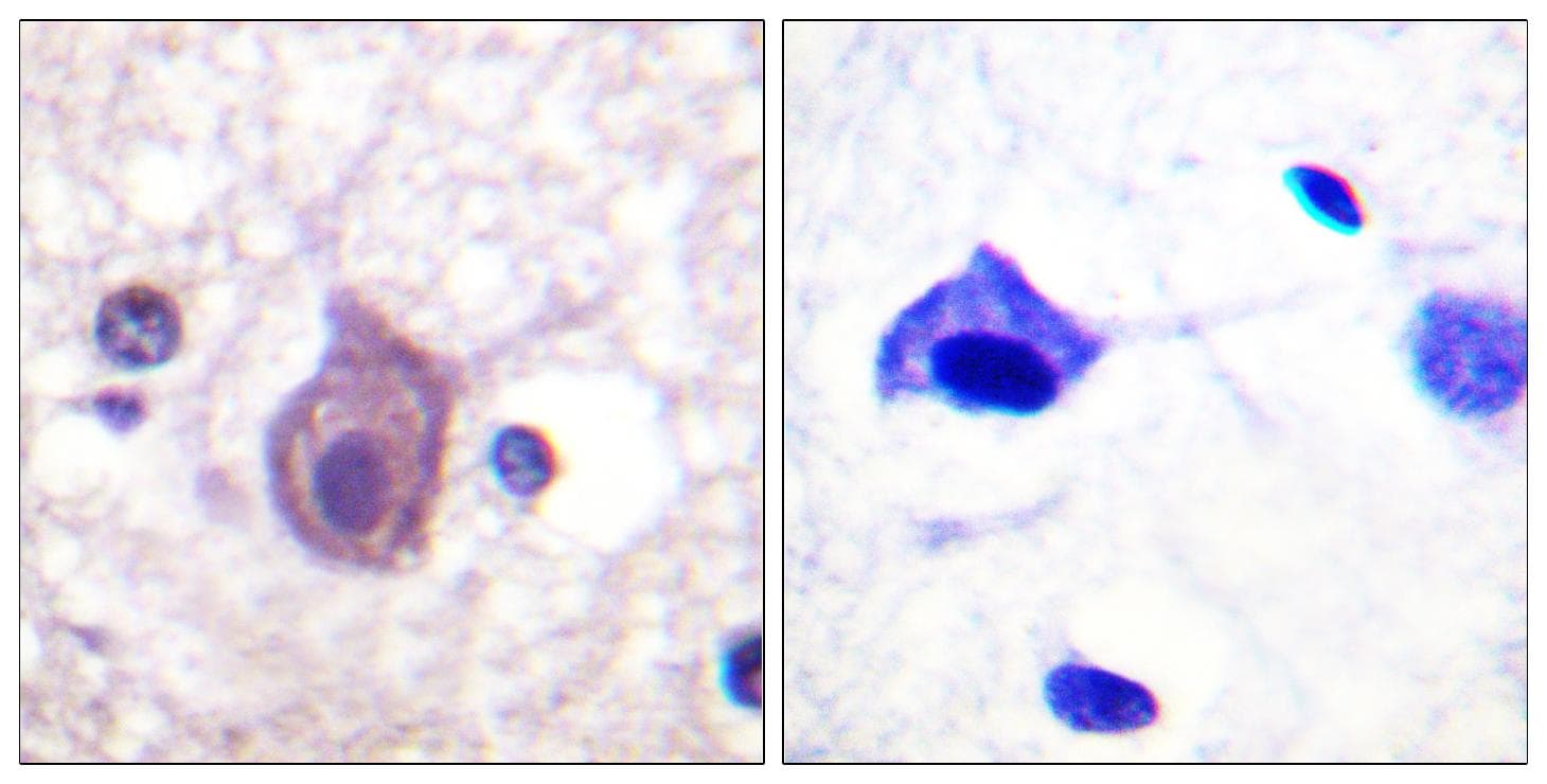 CD4 Antibody (phospho-Ser433)