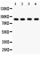 Polyclonal Rabbit anti-Human FURIN Antibody (aa591-794, WB)