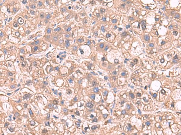Polyclonal Rabbit anti-Human SARS / Serine-tRNA Ligase Antibody (IHC, WB)
