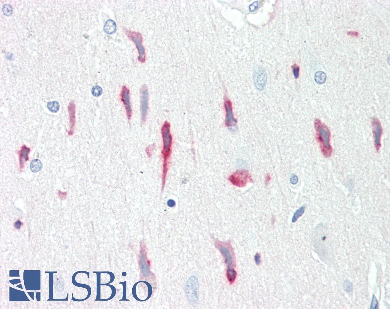IHC-plus™ PRNP / PrP / Prion Antibody (clone T16-R)