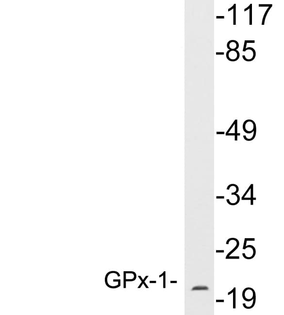 GPX1 / Glutathione Peroxidase Antibody (aa43-92)