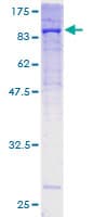 Human COL5A1 / Collagen V Alpha 1 Protein (Recombinant GST)