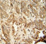 Polyclonal Rabbit anti-Human NAT14 Antibody (aa5-33, IHC, WB)