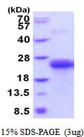 Human CLEC1B / CLEC-2 Protein (Recombinant His)