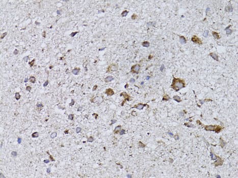 Polyclonal Rabbit anti-Human RARA / RAR Alpha Antibody (IHC, WB)