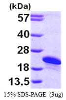 Human ARL2BP / BART Protein (Recombinant His)