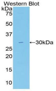 FASN / Fatty Acid Synthase Antibody (aa2263-2512)