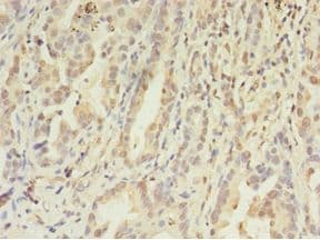 FGL2 Antibody (HRP)