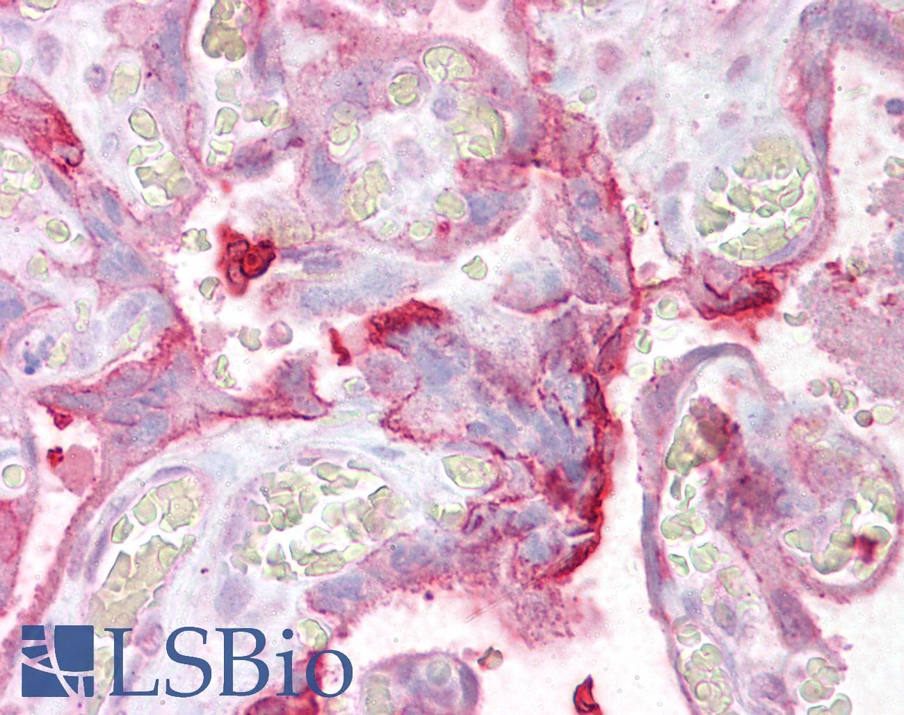 IHC-plus™ UBE2F Antibody (aa141-154)