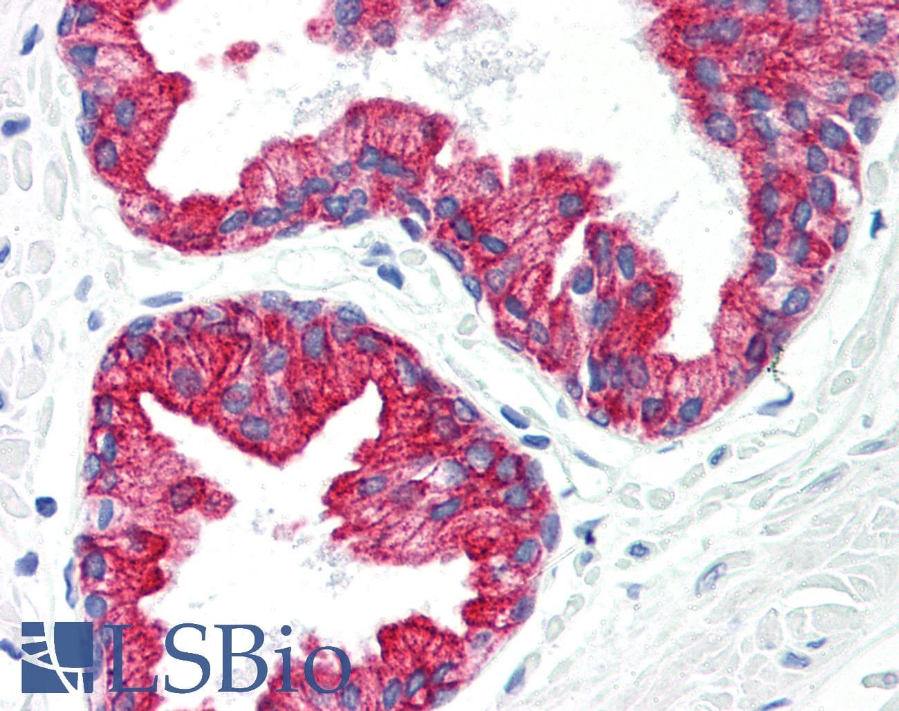 PathPlus™ Monoclonal Mouse anti-Human KRT8 / CK8 / Cytokeratin 8 Antibody (clone C-43, IHC, WB)