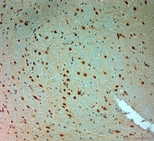 ARX Antibody (aa2-50)