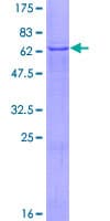 Human TMLHE / TMID Protein (Recombinant GST)